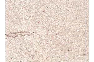 Immunohistochemistry analysis of human tonsil tissue (20x) using LAG-3 (human) recombinant mAb (L4-PL33), at a dilution of 1:50.