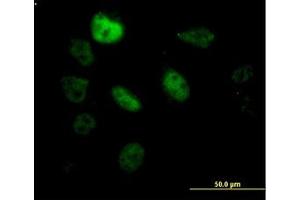 Image no. 1 for anti-Splicing Factor 3b, Subunit 2, 145kDa (SF3B2) (AA 592-646) antibody (ABIN599162) (SF3B2 antibody  (AA 592-646))