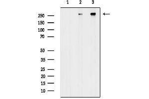 Western blot analysis of lysates from various samples, using IGF2R Antibody.