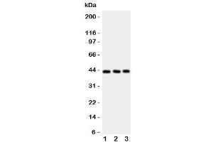 Western blot testing of CCR9 antibody and Lane 1:  Jurkat