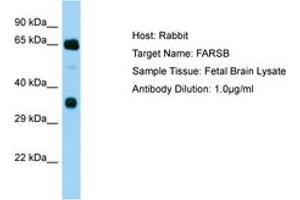 Image no. 1 for anti-Phenylalanyl-tRNA Synthetase, beta Subunit (FARSB) (AA 162-211) antibody (ABIN6750198) (FARSB antibody  (AA 162-211))