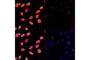 Immunofluorescence analysis of U-2 OS cells treated by TSA (upper left) and untreated U-2 OS cells (upper right) using Acetyl-Histone H3-K27 Rabbit pAb (red, ABIN7267670) at dilution of 1:100. (Histone 3 antibody  (H3K27))