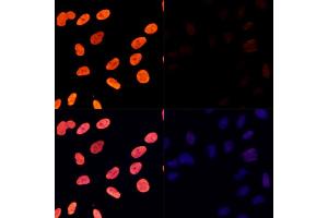 Immunofluorescence analysis of U-2 OS cells treated by TSA (upper left) and untreated U-2 OS cells (upper right) using Acetyl-Histone H3-K27 Rabbit pAb (red, ABIN7267670) at dilution of 1:100. (Histone 3 antibody  (H3K27))