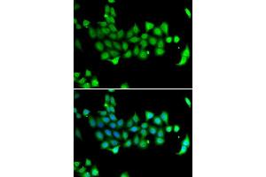 Immunofluorescence analysis of A549 cells using HSPA14 antibody. (HSPA14 antibody  (AA 240-509))