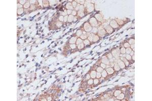 Immunohistochemistry of paraffin-embedded Human colon using MBTPS1 Polyclonal Antibody at dilution of 1:100 (40x lens). (MBTPS1 antibody)