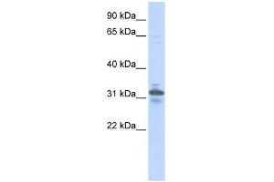 RPIA antibody used at 1 ug/ml to detect target protein. (Ribose 5-Phosphate Isomerase A (RPIA) antibody)
