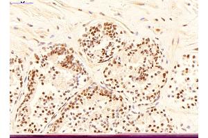 Sample Type: Normal Human Prostate Primary Antibody Dilution: 1 µg/mL Color/Signal Descriptions: YWHAE (DAB; brown), nuclei (hematoxylin; blue)  Gene Name: YWHAE (YWHAE antibody  (C-Term))