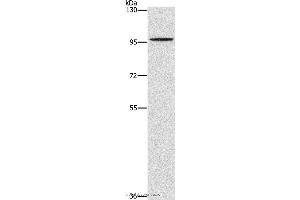 Western blot analysis of A172 cell, using PDE6C Polyclonal Antibody at dilution of 1:1400