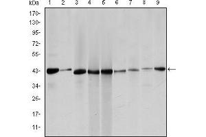 Western blot analysis using ACTA2 mouse mAb against Hela (1), Jurkta (2), HepG2 (3), MCF-7 (4), A431 (5), A549 (6), PC-12 (7), NIH/3T3 (8) and Cos7 (9) cell lysate. (Smooth Muscle Actin antibody)