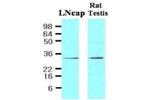 Cell lysates of LNcap (30ug) and Rat testis (30ug) were resolved by SDS-PAGE, transferred to NC membrane and probed with anti-human STEAP1 (1:500). (STEAP1 antibody  (AA 1-70))