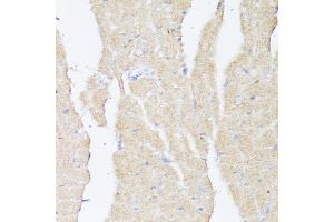 Immunohistochemistry of paraffin-embedded mouse heart using BMPR2 antibody (ABIN7265906) at dilution of 1:100 (40x lens). (BMPR2 antibody  (AA 27-150))