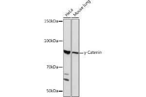 Western blot analysis of extracts of various cell lines, using γ-Catenin Rabbit mAb (ABIN1683043, ABIN3018625, ABIN3018626 and ABIN7101634) at 1:1000 dilution.