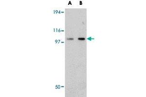 Western blot analysis of FAM120B in rat thymus tissue lysate with FAM120B polyclonal antibody  at (A) 0.