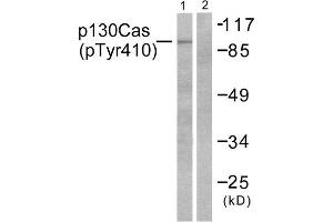 Western Blotting (WB) image for anti-Breast Cancer Anti-Estrogen Resistance 1 (BCAR1) (pTyr410) antibody (ABIN1847248) (BCAR1 antibody  (pTyr410))