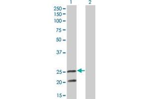 Western Blot analysis of IL6 expression in transfected 293T cell line by IL6 monoclonal antibody (M05), clone 3E8. (IL-6 antibody  (AA 29-212))