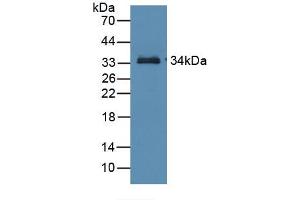 Figure. (RBP3 antibody  (AA 18-320))