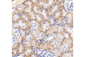 Immunohistochemistry of paraffin embedded rat kidney using MRPS35 (ABIN7074655) at dilution of 1: 400 (300x lens) (MRPS35 antibody)