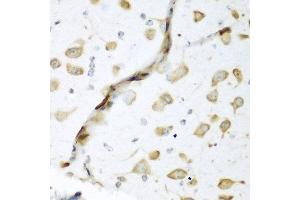 Immunohistochemistry of paraffin-embedded mouse brain using ELAVL2 antibody at dilution of 1:200 (40x lens). (ELAVL2 antibody)