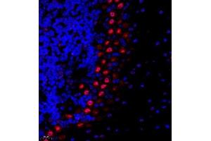 Immunofluorescence of paraffin embedded mouse cerebellum using USP27 (ABIN7076113) at dilution of 1:1500 (400x lens) (USP27X antibody)