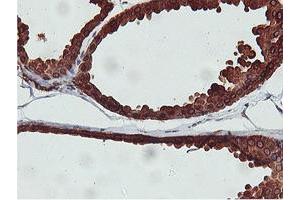 Immunohistochemical staining of paraffin-embedded Human breast tissue using anti-C20orf3 mouse monoclonal antibody. (APMAP antibody)