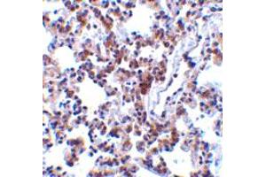 Immunohistochemistry of BCAP31 in rat lung tissue with BCAP31 polyclonal antibody  at 2 ug/mL .