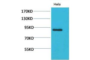 Western Blot (WB) analysis of HeLa using Stat4 Polyclonal Antibody. (STAT4 antibody)