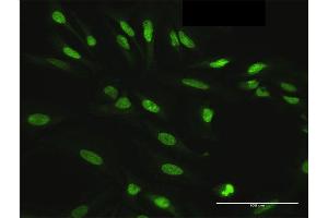 Immunofluorescence of purified MaxPab antibody to HDGFRP3 on HeLa cell. (HDGFRP3 antibody  (AA 1-203))