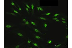 Immunofluorescence of purified MaxPab antibody to HDGFRP3 on HeLa cell.