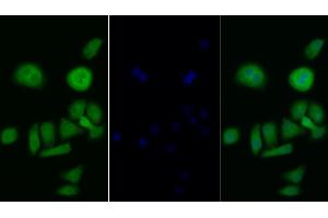 Detection of PIK3Cb in Human Hela cell using Polyclonal Antibody to Phosphoinositide-3-Kinase Catalytic Beta Polypeptide (PIK3Cb) (PIK3CB antibody  (AA 524-703))