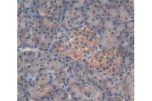 Used in DAB staining on fromalin fixed paraffin- embedded pancreas tissue (EPRS antibody  (AA 749-956))