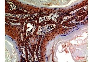 Immunohistochemistry (IHC) analysis of paraffin-embedded Human Skin, antibody was diluted at 1:200. (ADAMTS18 antibody)