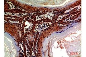 Immunohistochemistry (IHC) analysis of paraffin-embedded Human Skin, antibody was diluted at 1:200.