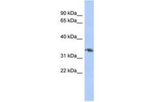 Image no. 1 for anti-Homeobox D10 (HOXD10) (AA 143-192) antibody (ABIN6744410)