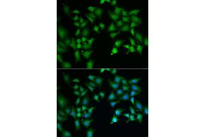 Immunofluorescence analysis of A549 cell using FLOT2 antibody.