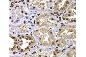 Immunohistochemistry of paraffin-embedded Human kidney using DNAJB6 Polyclonal Antibody at dilution of 1:100 (40x lens).