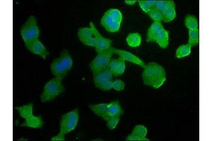 Immunofluorescence staining of PC-3 cells with ABIN7140074 at 1:266, counter-stained with DAPI. (GPR37 antibody  (AA 114-133))
