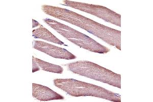 (ABIN6242693 and ABIN6578667) staining Vinculin in mouse skeletal muscle tissue sections by Immunohistochemistry (IHC-P - paraformaldehyde-fixed, paraffin-embedded sections). (Vinculin antibody  (AA 634-668))