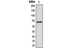 Western blot analysis of FATP5 expression in HeLa (A) whole cell lysates. (SLC27A5 antibody  (Center))