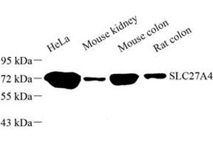 Western blot analysis of SLC27A4 (ABIN7075671) at dilution of 1: 500
