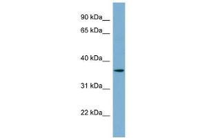 C1ORF75 antibody used at 1 ug/ml to detect target protein. (TMEM206 antibody  (N-Term))