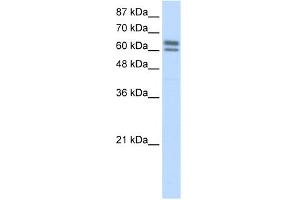 WB Suggested Anti-BTBD14B Antibody Titration:  5. (NAC1 antibody  (C-Term))