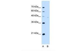 Image no. 2 for anti-Neuroplastin (NPTN) (AA 201-250) antibody (ABIN321178) (NPTN antibody  (AA 201-250))
