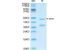 Cynomolgus GDF15 on Tris-Bis PAGE under reduced condition. (GDF15 Protein (AA 197-308) (Fc Tag))