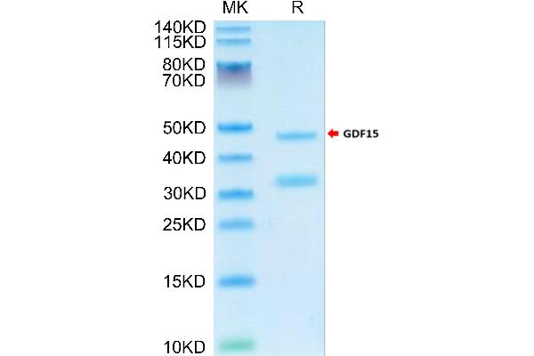 GDF15 Protein (AA 197-308) (Fc Tag)