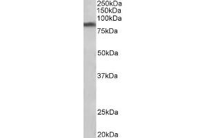 ABIN940564 (1µg/ml) staining of Human Substantia nigra lysate (35µg protein in RIPA buffer). (SLC6A3 antibody  (Internal Region))