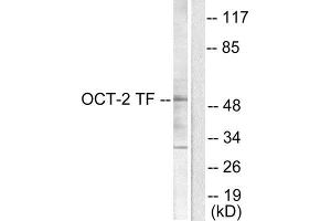 Western Blotting (WB) image for anti-POU domain, class 2, transcription factor 2 (POU2F2) (N-Term) antibody (ABIN1848707) (Oct-2 antibody  (N-Term))