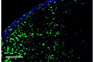 Immunohistochemistry analysis using Mouse Anti-Hexanoyl-Lysine adduct Monoclonal Antibody, Clone 5D9 (ABIN5067239). (Hexanoyl-Lysine Adduct (HEL) antibody (Atto 594))