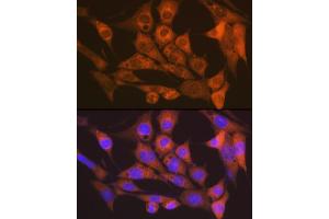 Immunofluorescence analysis of NIH-3T3 cells using CaMKII delta Rabbit mAb (ABIN7266019) at dilution of 1:100 (40x lens). (CAMK2D antibody)