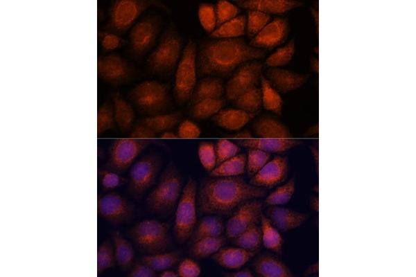 KIF13A antibody  (AA 1300-1600)