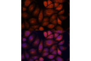 Immunofluorescence analysis of HeLa cells using KIF13A antibody (ABIN7268122) at dilution of 1:100.